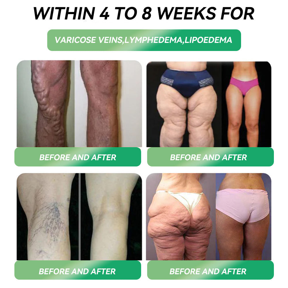 𝐎𝐟𝐟𝐢𝐜𝐢𝐚𝐥 𝐒𝐭𝐨𝐫𝐞 | 𝐇𝐇𝐕𝐁® 𝐆𝐋𝐏-𝟏 𝐖𝐞𝐢𝐠𝐡𝐭 𝐋𝐨𝐬𝐬 𝐎𝐫𝐚𝐥 𝐒𝐨𝐥𝐮𝐭𝐢𝐨𝐧 – 𝐎𝐛𝐞𝐬𝐢𝐭𝐲, 𝐂𝐚𝐫𝐝𝐢𝐨𝐯𝐚𝐬𝐜𝐮𝐥𝐚𝐫 𝐃𝐢𝐬𝐞𝐚𝐬𝐞,💥🔥  𝐃𝐢𝐚𝐛𝐞𝐭𝐞𝐬, 𝐒𝐥𝐞𝐞𝐩 𝐀𝐩𝐧𝐞𝐚, 𝐉𝐨𝐢𝐧𝐭 𝐏𝐫𝐨𝐛𝐥𝐞𝐦𝐬, 𝐚𝐧𝐝 𝐌𝐨𝐫𝐞 🌟